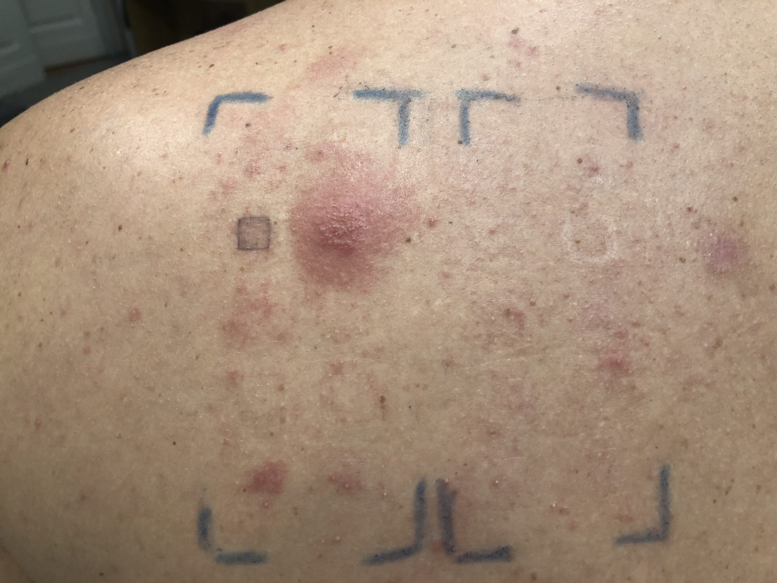 foto patologia allergologica