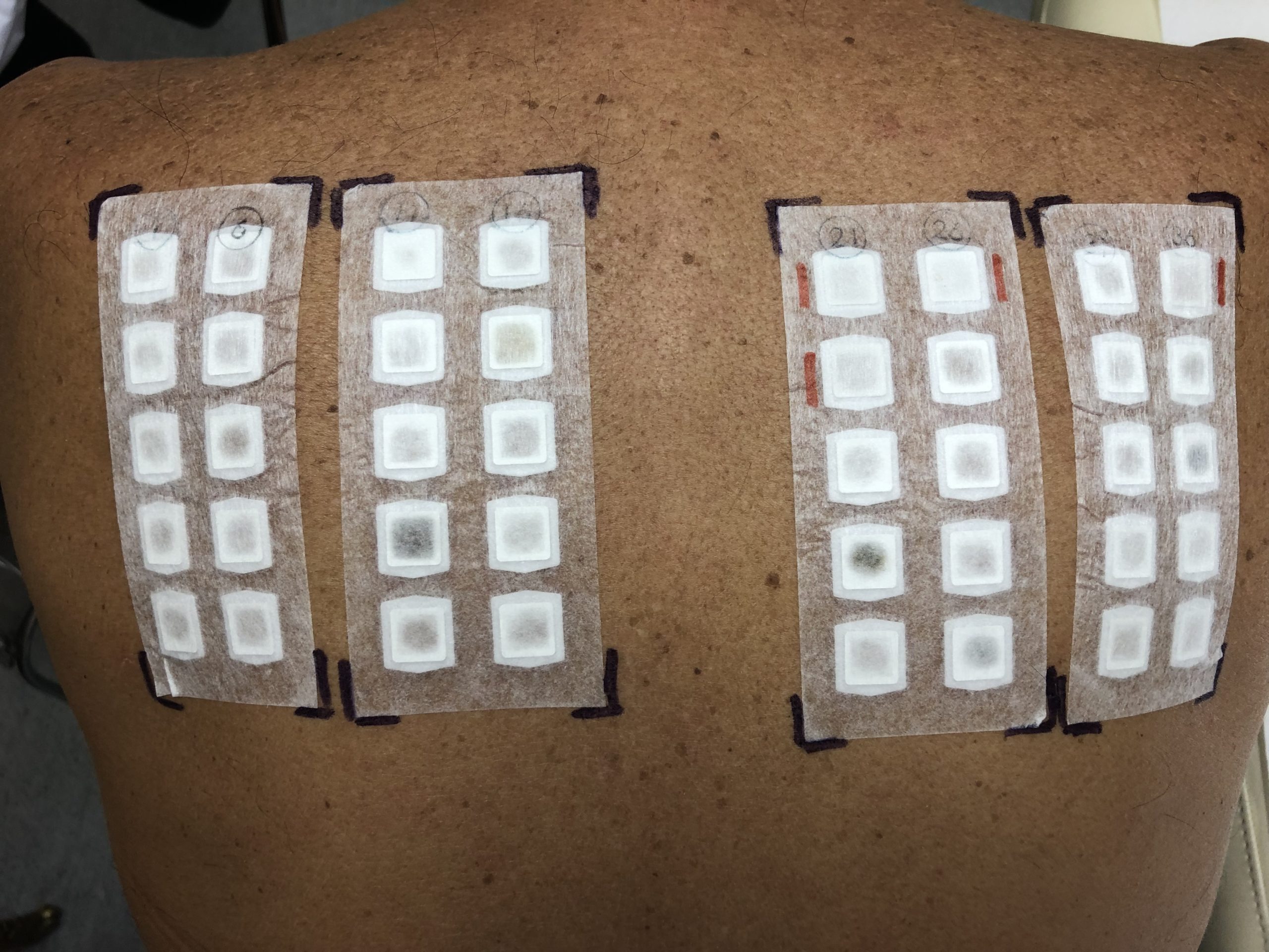 foto medicamento su patologia allergologica